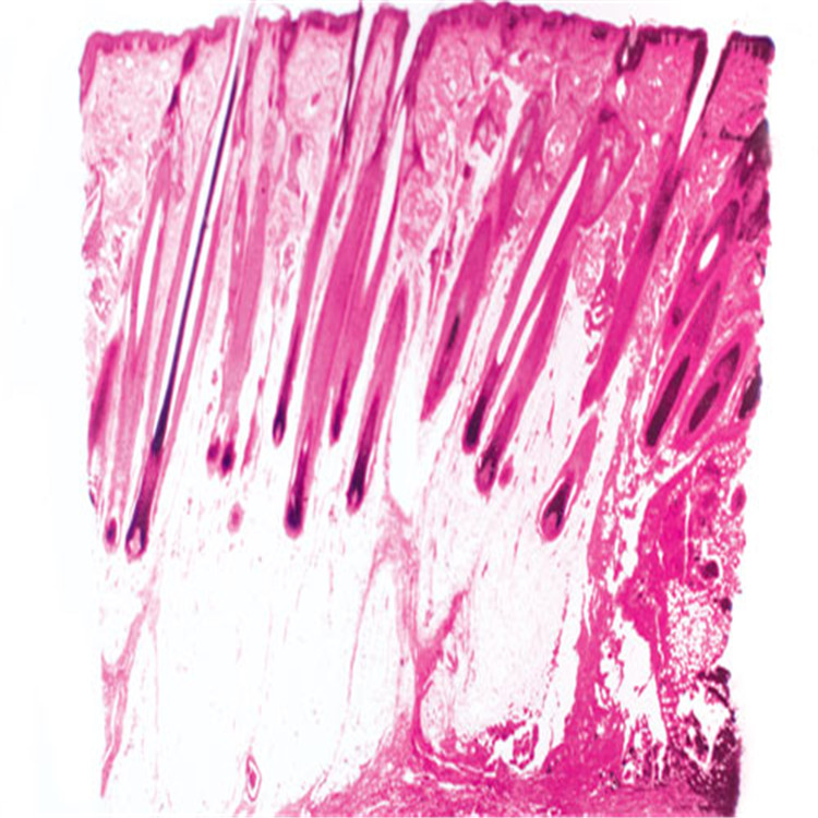 人皮膚切片示毛囊